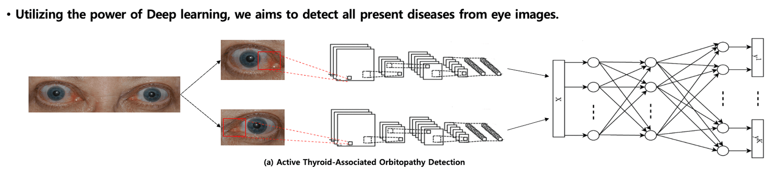Active Thyroid-Associated Orbitopathy Detection on Eye Photographs